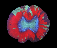 Open brain bicolor wysiwyg